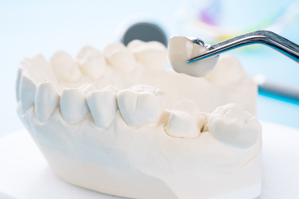 How To Take Care Of A Dental Crown